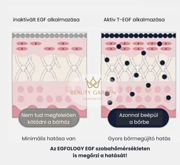 egfology egf velemeny exoszóma